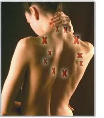 trigger point injections north tampa